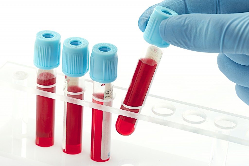 HIV blood tests